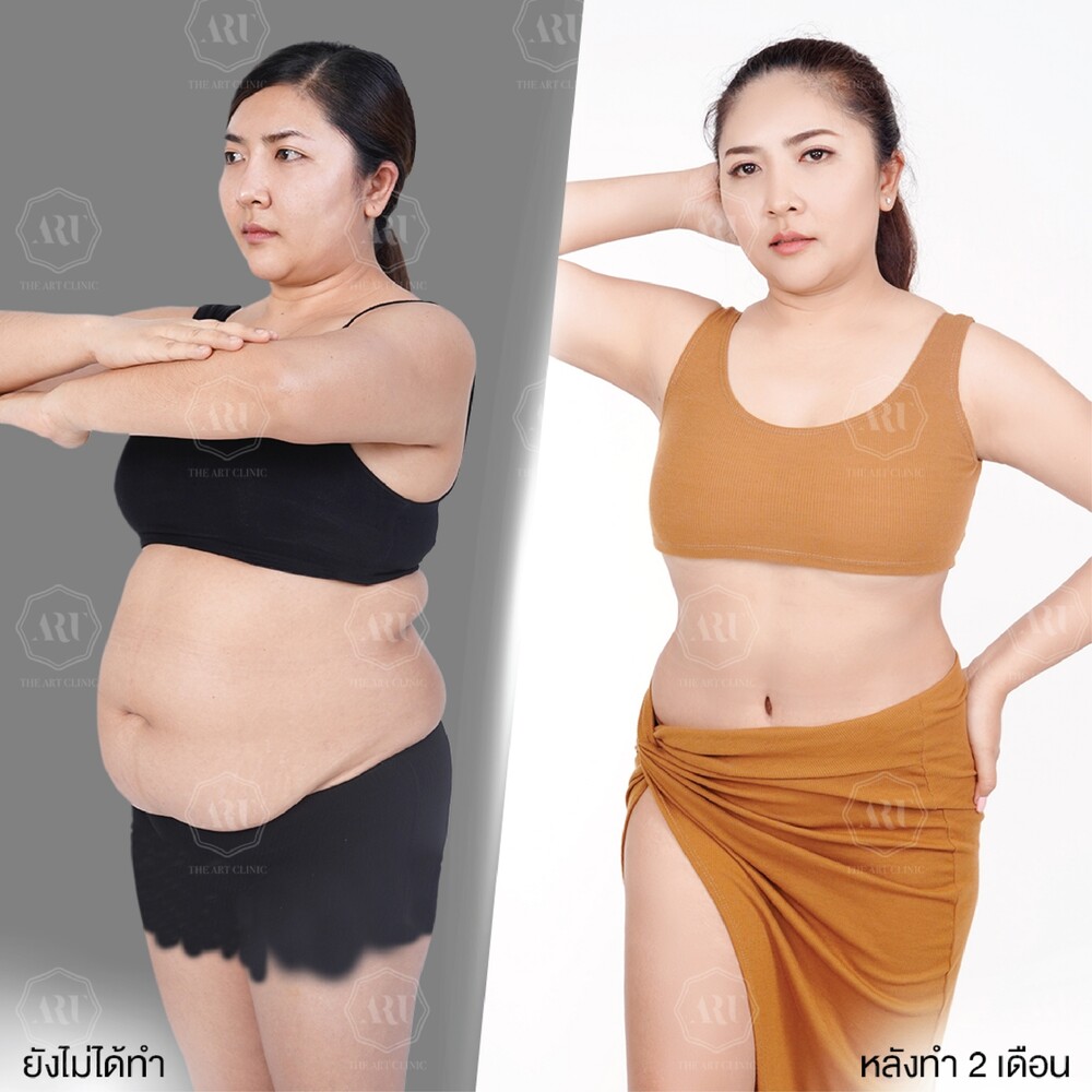 Before and After Result